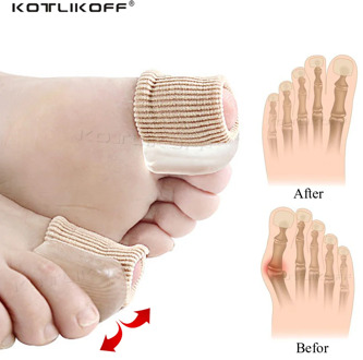 1 pcs Toe Separator Hallux Valgus Bunion Corrector Orthotics Feet Bone Thumb Adjuster Correction Pedicure Sock Straightener Pads