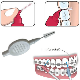 10 stuks Plastic Rager 0.7mm Tanden Reinigen Borstels Orthodontische Tand Flossen Tandheelkundige Tandenstoker Draaien Oral Care