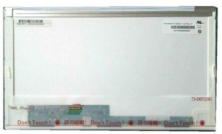 15.6" LED WUXGA HD 1920x1080 30 Pin Notebook Glossy Scherm for Dell E6510 - small