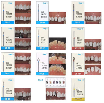 1Box Dental Diamond Burs Drill Dental Burs Dia-burs for High Speed Handpiecess Medium Dentist Tools