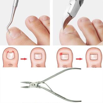 2 Stks/set Ingegroeide Ingegroeide Teennagels Nipper Clipper Dode Huid Vuil Remover Cutters Paronychia Podologie Pedicure Care Tool 2U0611