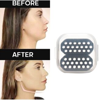 2Pcs Jaw Exerciser Kaaklijn Trainer Oefening Bal Kaaklijn Lijn Chew Bal Workout Spier 2 stk zwart