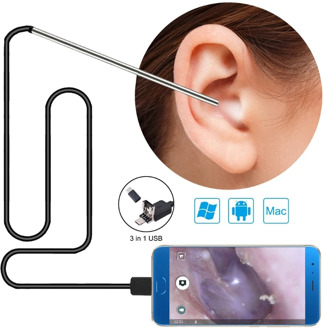 3 in 1 Ear Wax Removal Tool,USB Otoscope-Ear Scope Camera In Ear Cleaning Endoscope Visual Ear Spoon 5.5mm Ear pick Otoscope