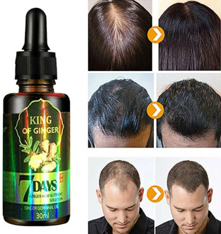 30ml Ginger Hair Growth Nutrient Solution Hair Loss Oil Hair Women Protection Treatment For Men Essential X6X5