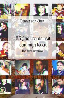 35 Jaar en de rest van mijn Leven -  Dennis van Elten (ISBN: 9789464357196)