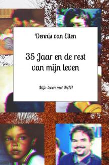 35 Jaar En De Rest Van Mijn Leven - Dennis Van Elten