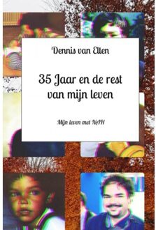 35 Jaar En De Rest Van Mijn Leven - Dennis Van Elten