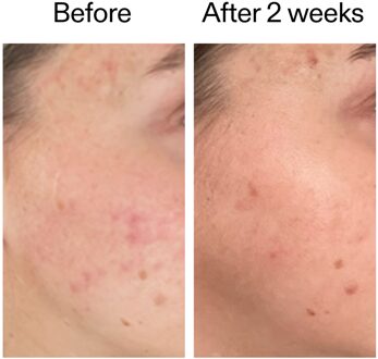 360 Skin Clearing Serum 30ml