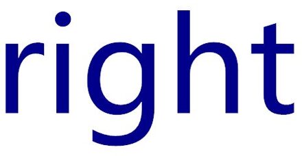 92301H1010 92302H1010 Hoek Lamp Combinatie Front Lh En Rh Voor Hyundai Terracan Bochten Lamp Breed Licht rechtsaf