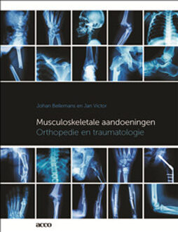 Acco Uitgeverij Musculoskeletale aandoeningen - Boek Johan Bellemans (9463443894)