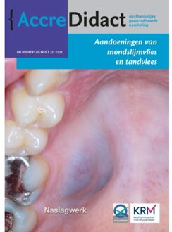 AccreDidact MH2021-2 -   Aandoeningen van mondslijmvlies en tandvlees