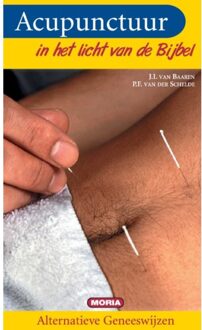 Acupunctuur in het licht van de bijbel