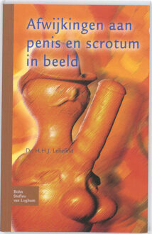 Afwijkingen aan penis en scrotum in beeld - Boek Leliefeld (9031352926)