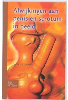 Afwijkingen aan penis en scrotum in beeld - Boek Leliefeld (9031352926)