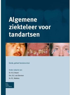 Algemene ziekteleer voor tandartsen - Boek Springer Media B.V. (9031387282)