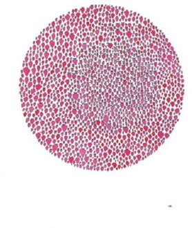 An Abundance Of Strawberries