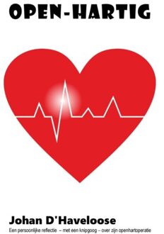Aquazz Open-Hartig - Johan D' HAVELOOSE