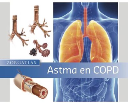 Astma en COPD + Marker - Boek T.J. Klemmeier (9491984276)