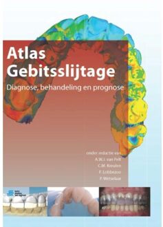 Atlas gebitsslijtage - Boek Springer Media B.V. (9036805376)