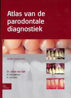Atlas van de parodontale diagnostiek - Boek Johan van Dijk (9031388092)