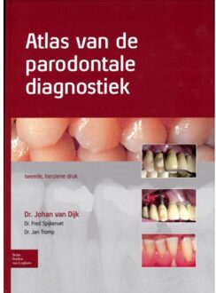 Atlas van de parodontale diagnostiek - Boek Johan van Dijk (9031388092)