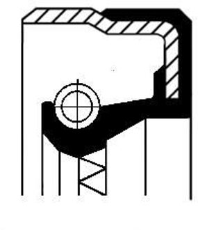 Audi Keerring, verdeeldifferentieel 01035170B