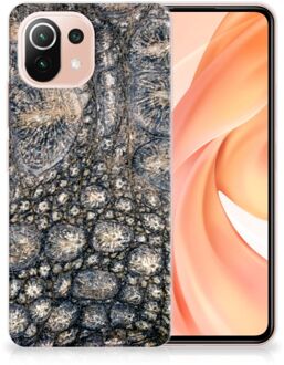 B2Ctelecom Hippe Hoesjes Xiaomi Mi 11 Lite Telefoon Hoesje Krokodillenprint