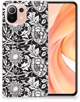 B2Ctelecom Telefoon Hoesje Xiaomi Mi 11 Lite Mobiel Case Zwart Bloemen