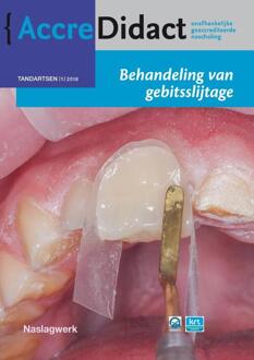 Behandeling van gebitsslijtage - Boek Peter Wetselaar (9089762779)