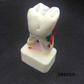 best Dentist Dental Study Teach Tooth Model Teeth Disease Model new
