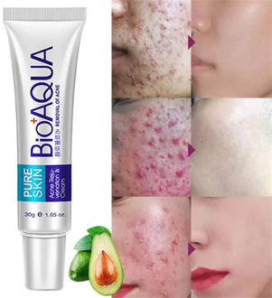 BIOAQUA Acne Removal Cream Gel Anti-Acne Scar Treatment Skin Care Face Whitening Cream Moisturizing Oil Control Acne Remover 30g