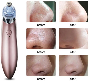 Blackhead Remover Face Deep Nose Cleaner T Zone Pore Acne Pimple Removal Vacuum Suction Facial Diamond Beauty Clean Skin Tool
