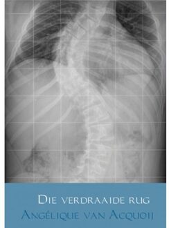 Brave New Books Die verdraaide rug - (ISBN:9789402113327)