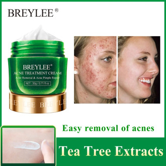 BREYLEE Acne Treatment Cream Anti Acne Face Cream Remove Pimple Spots Oil Control Shrink Pores Smoothing Skin Care Tea Tree 20g