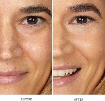 By Terry Hyaluronic Serum Concealer (Various Shades) - 7. Warm Beige