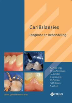 Carieslaesies - Boek A.J.P. van Strijp (9085621305)