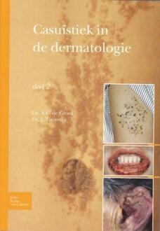 Casuïstiek in de dermatologie - Boek Johan Toonstra (9031384577)