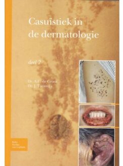 Casuïstiek in de dermatologie - Boek Johan Toonstra (9031384577)