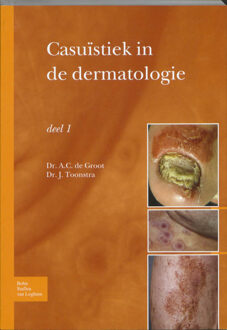 Casuïstiek in de dermatologie / deel 1 - Boek A.C. de Groot (9031361887)