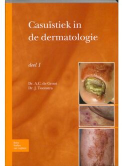 Casuïstiek in de dermatologie / deel 1 - Boek A.C. de Groot (9031361887)