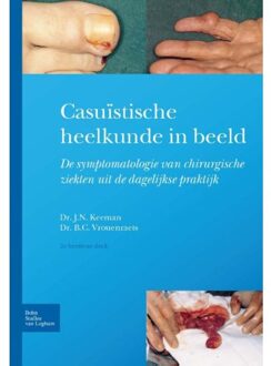 Casuistische heelkunde in beeld - Boek J.N. Keeman (9031392286)