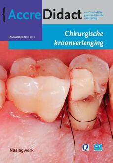 Chirurgische kroonverlenging - Boek S. Paraskevas (9089761950)