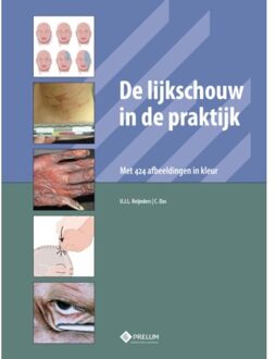 De lijkschouw in de praktijk - Boek U.J.L. Reijnders (908562150X)