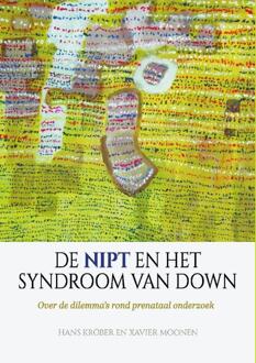 De NIPT en het syndroom van Down -  Hans Kröber, Xavier Moonen (ISBN: 9789492261939)