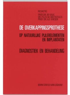 De overkappingsprothese op natuurlijke pijlerelementen en implantaten - Boek W. Kalk (9031311529)