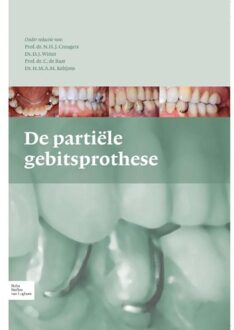 De partiele gebitsprothese - Boek Springer Media B.V. (9031375756)
