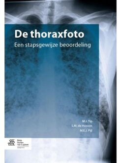 De thoraxfoto - Boek M.J. Tip (9031391239)