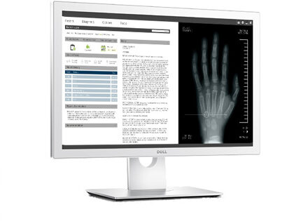 Dell MR2416 Medical Ledmonitor