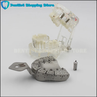 Dental Implant Impression Tray Removing Segments Position of the Abutments