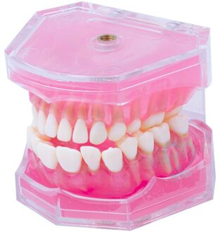 Dental Onderwijs Model Standaard Model Removable Tanden Zachte Gom Model